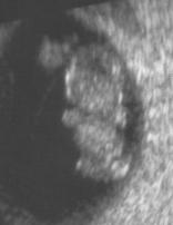 8 weeks: head, arms, legs, about 1 inch (2.5 cm) tall - click for larger picture